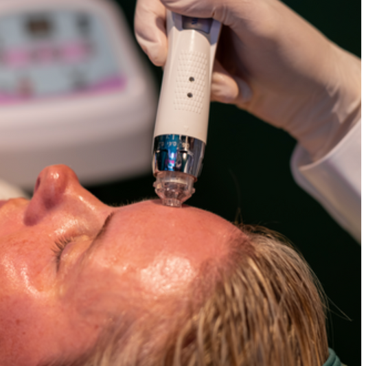 Before Your Skin Needling Treatment
