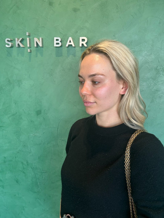 Skin Needling: Treatment Planning & Results