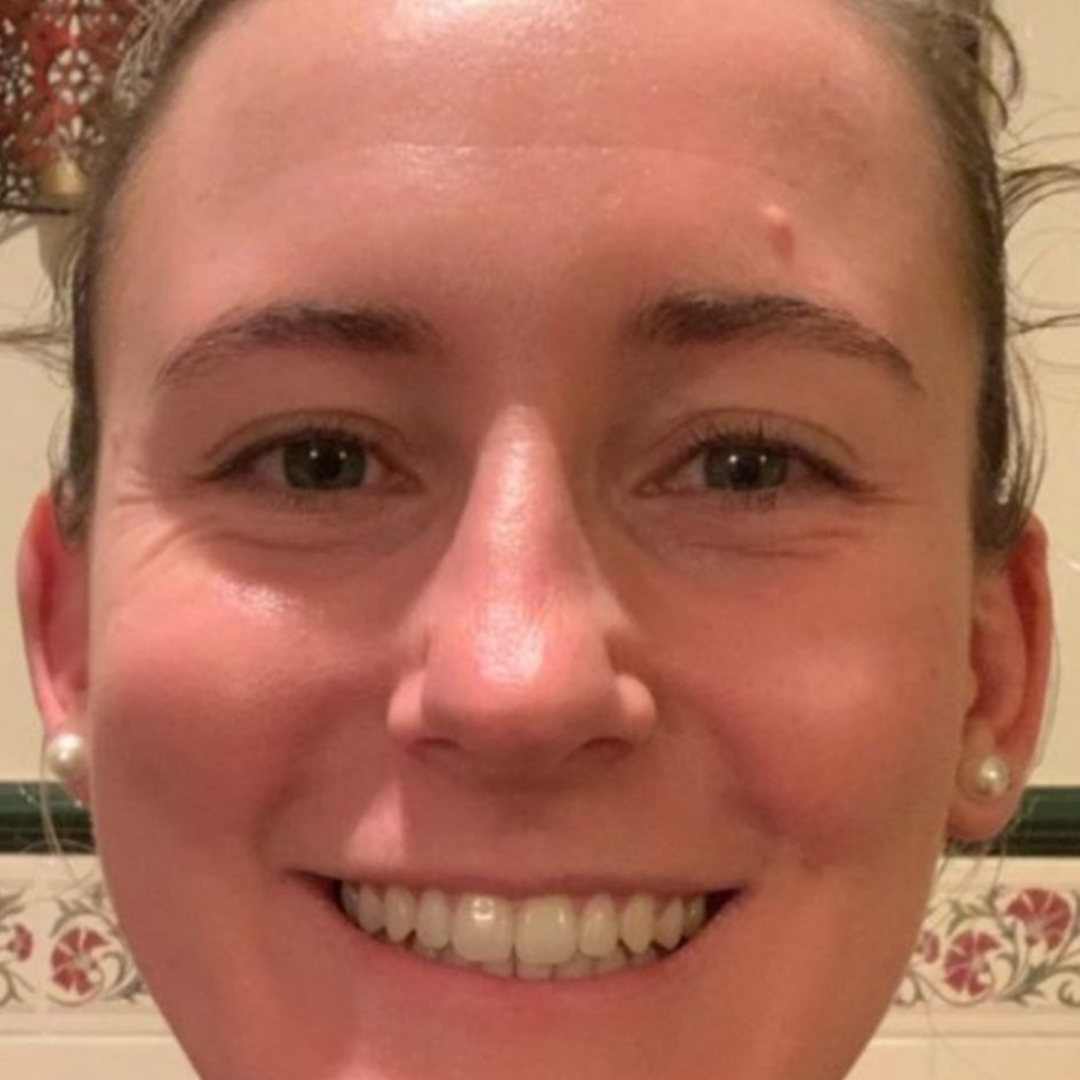 Cosmelan Peel