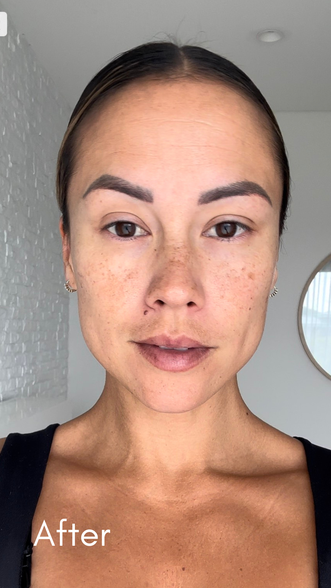 New Client | RF Needling, Skin Consultation & LED Therapy