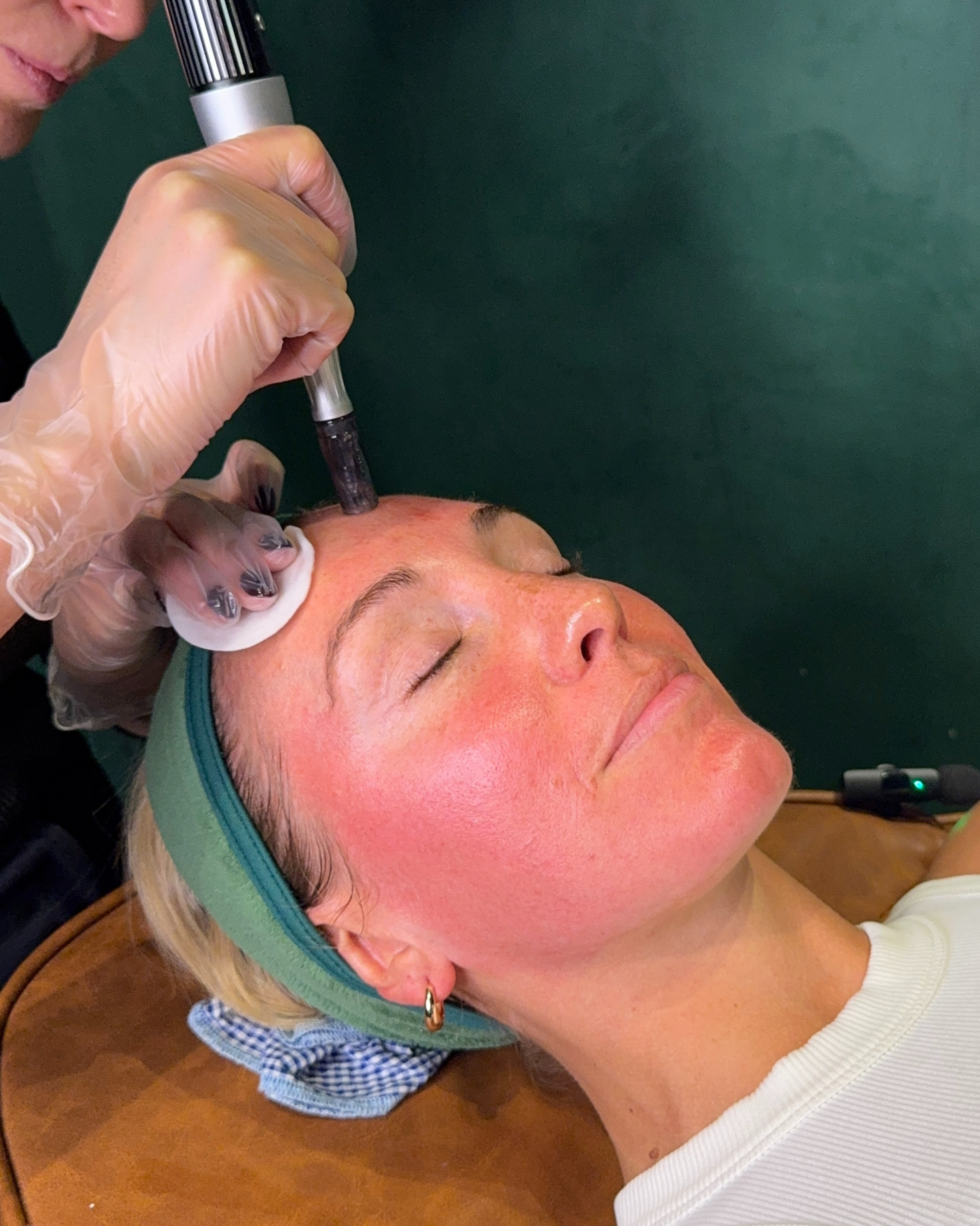 Skin Needling x 3 Pack