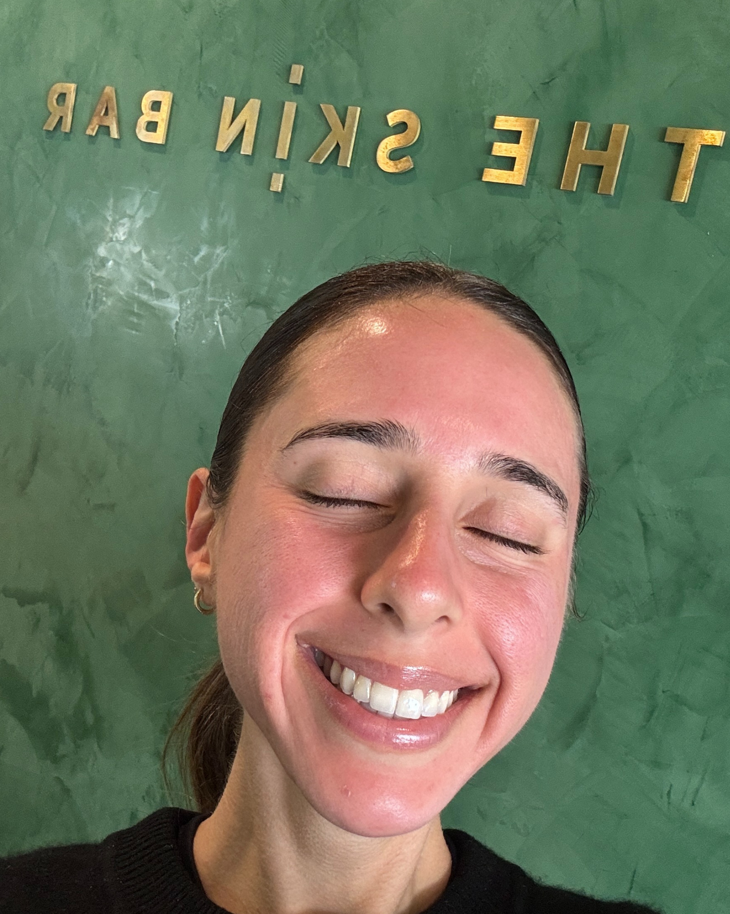 Skin Needling