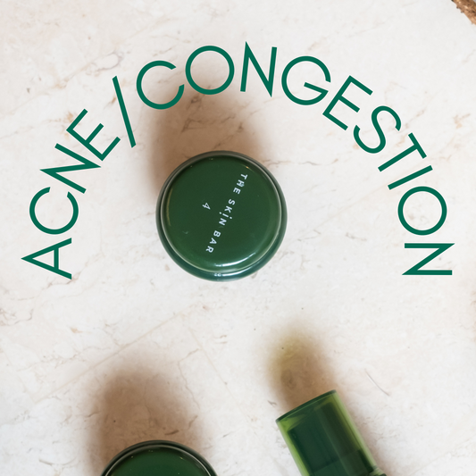 DIY Acne/ Congestion Facial