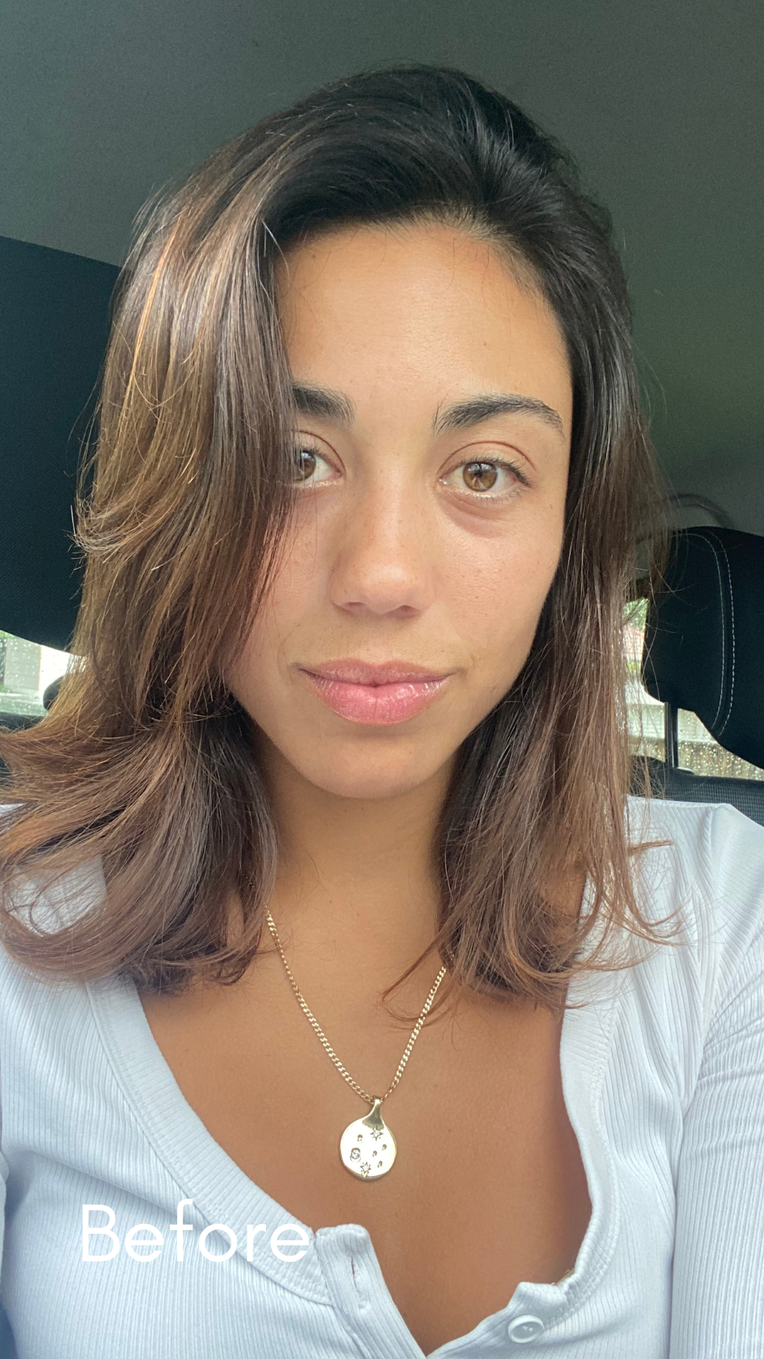 New Client | Consultation + Enzyme Peel + LED