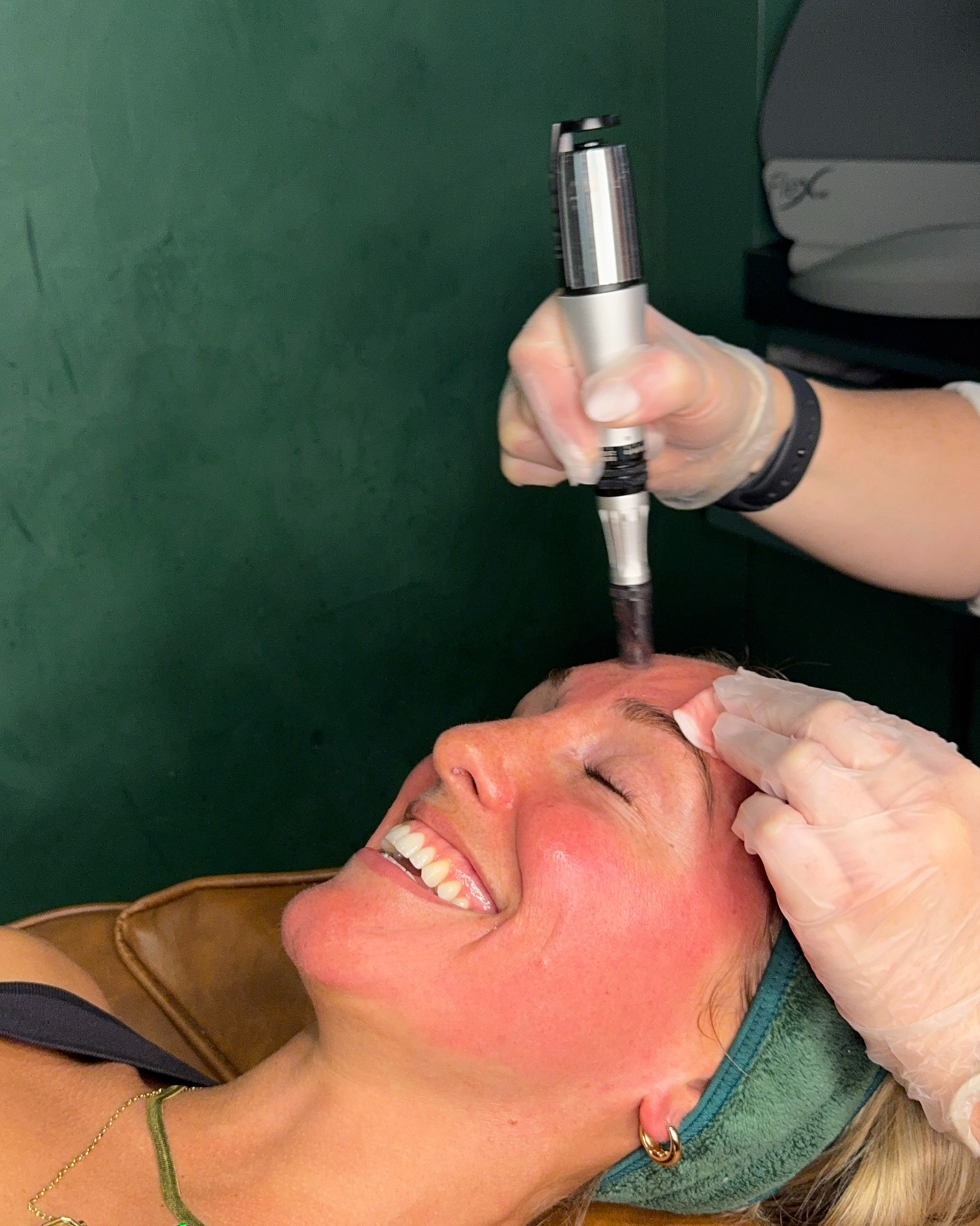 Skin Needling x 3 Pack