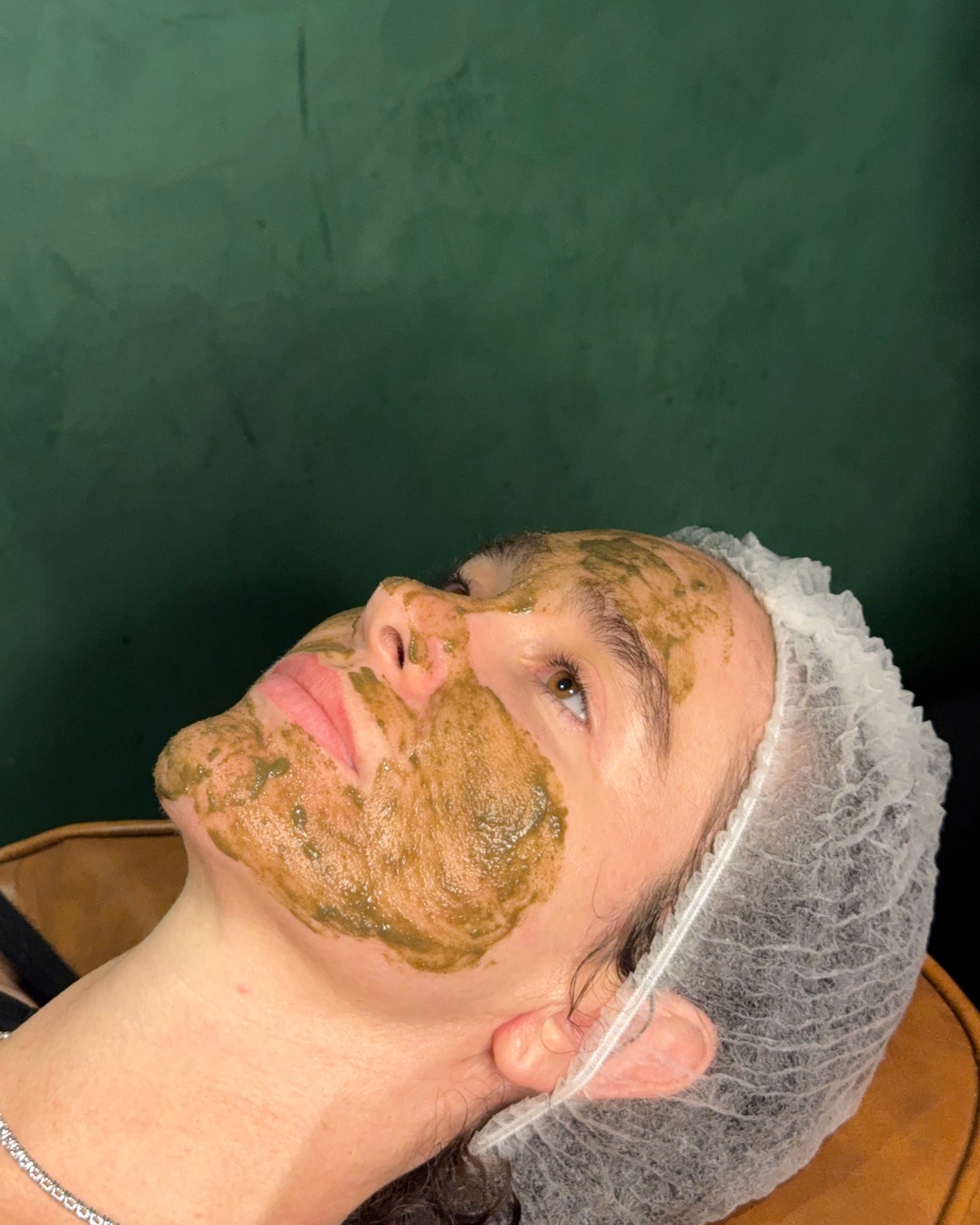 K-Beauty Spicule Treatment