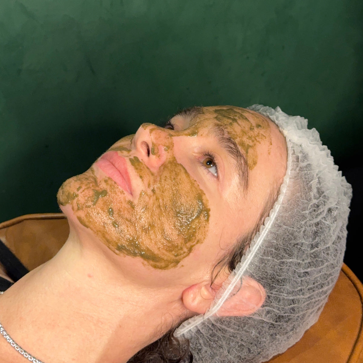K-Beauty Spicule Treatment