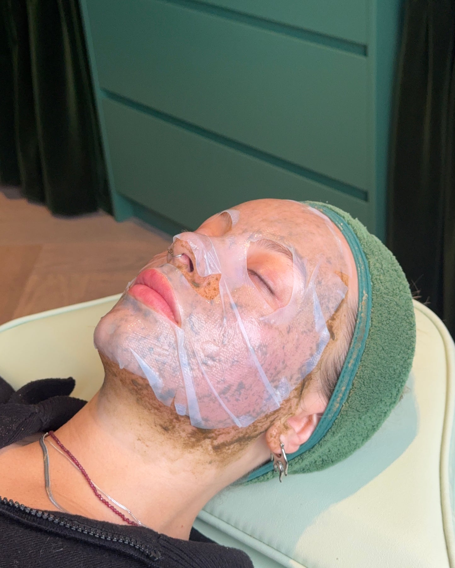 K-Beauty Spicule Treatment