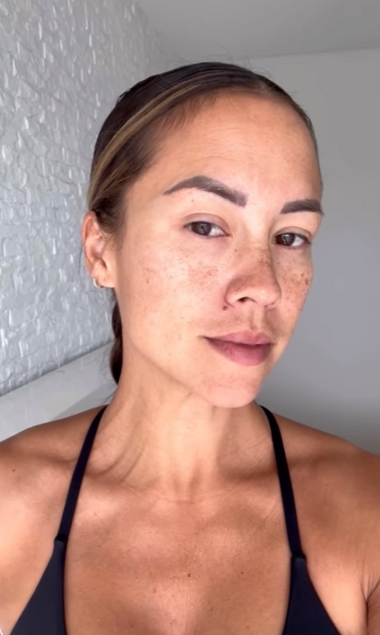 New Client | RF Needling, Skin Consultation & LED Therapy