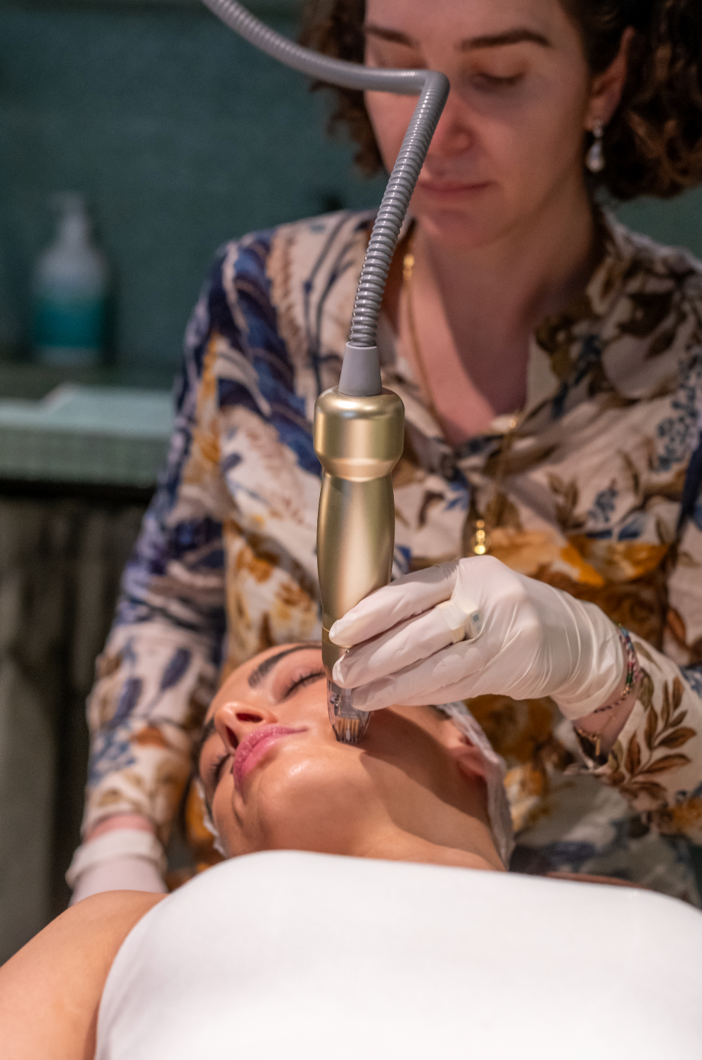 RF Needling with Exosomes