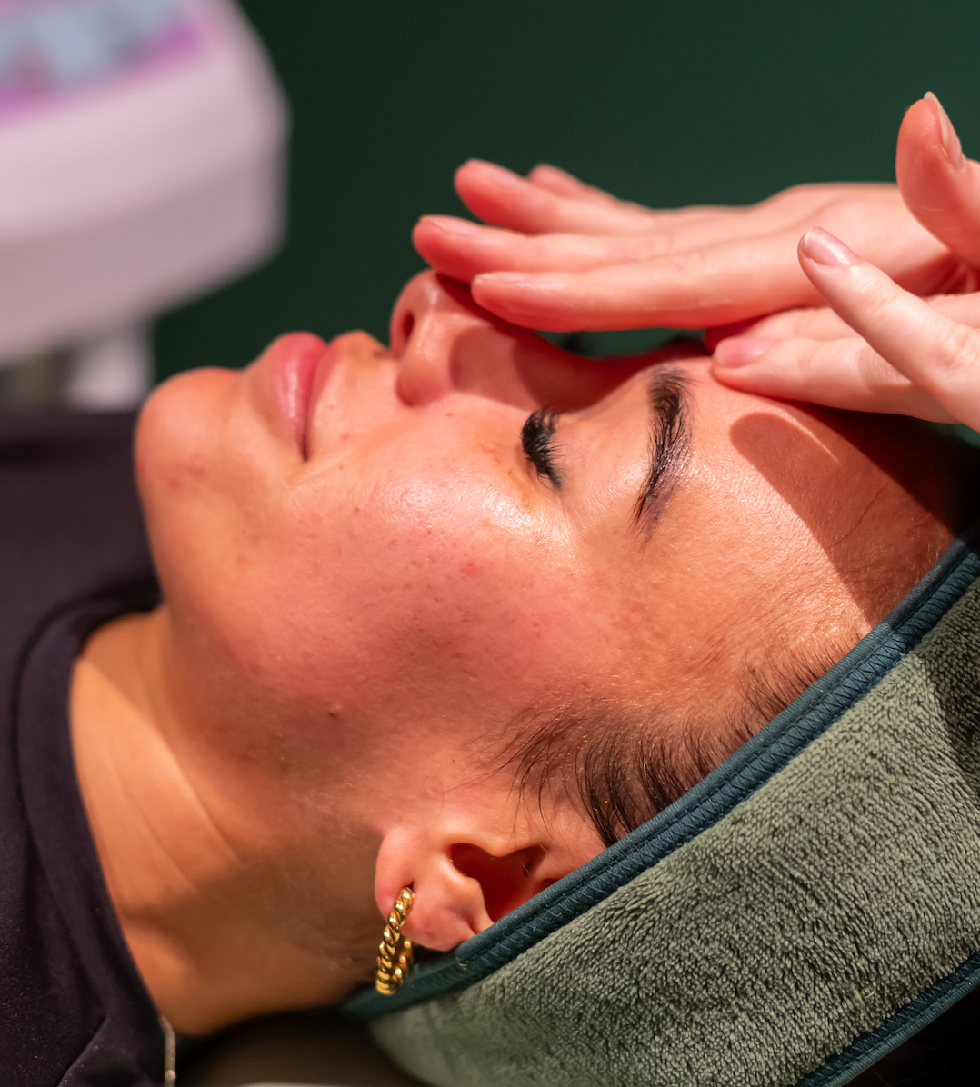 Winter New Client Skin Needling Promotion