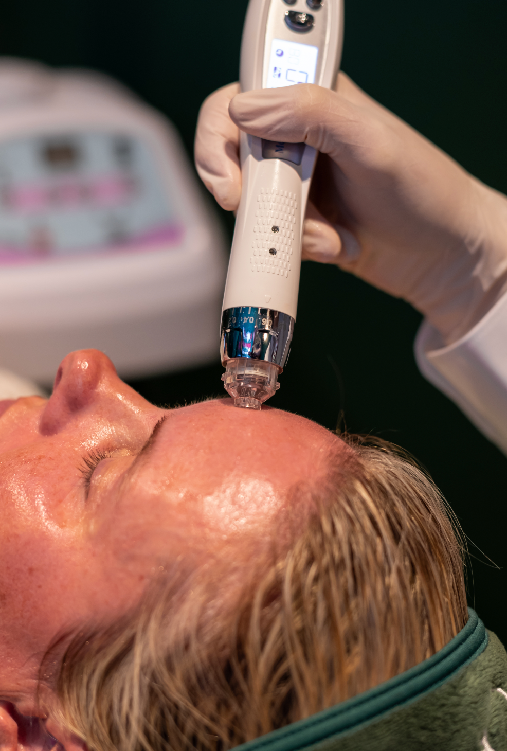 New Client | Skin Needling + Skin Consultation + LED | Online