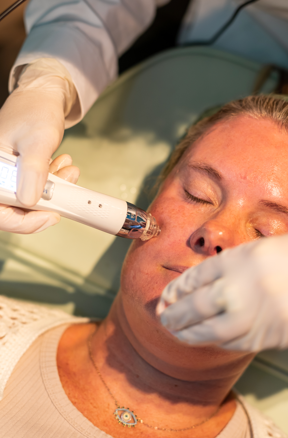 New Client | Skin Needling + Skin Consultation + LED | Online