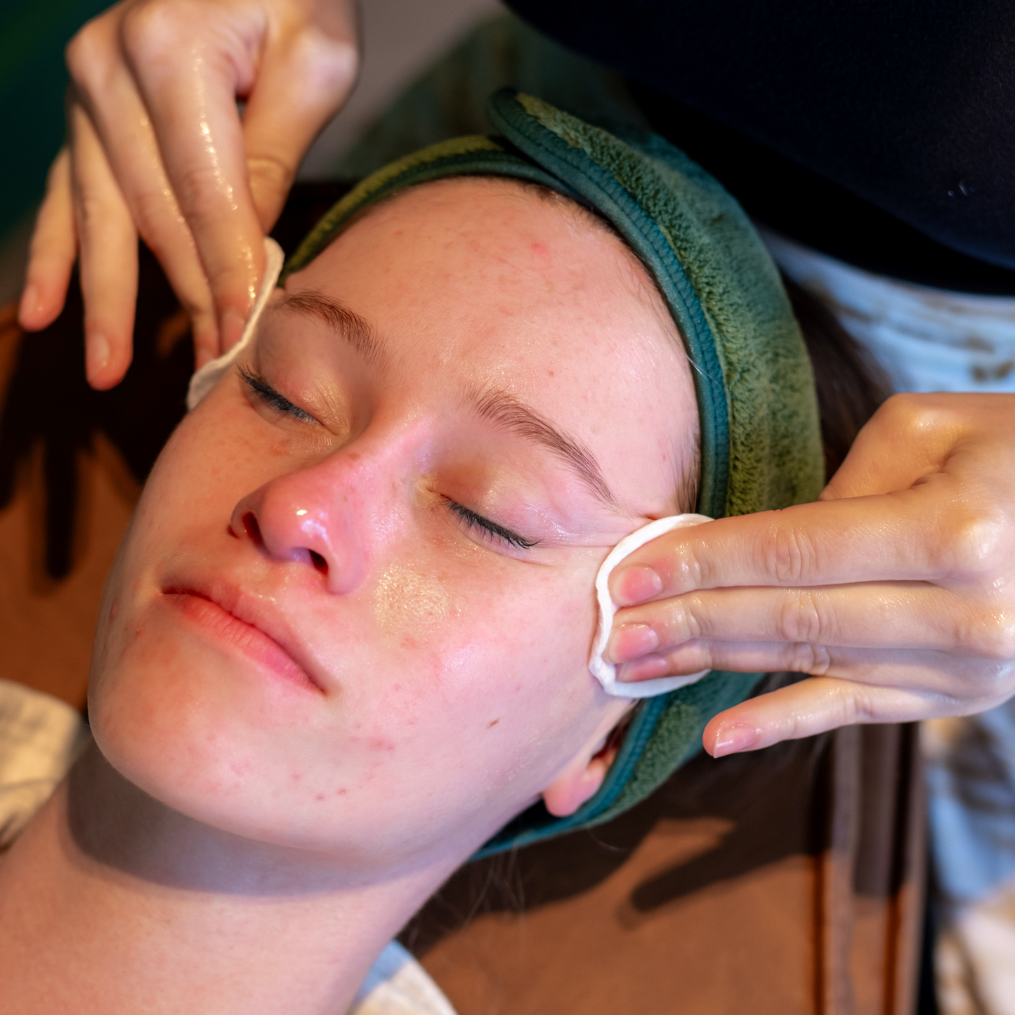 Newcastle Exclusive: First-Time Enzyme Peel with Consultation & LED