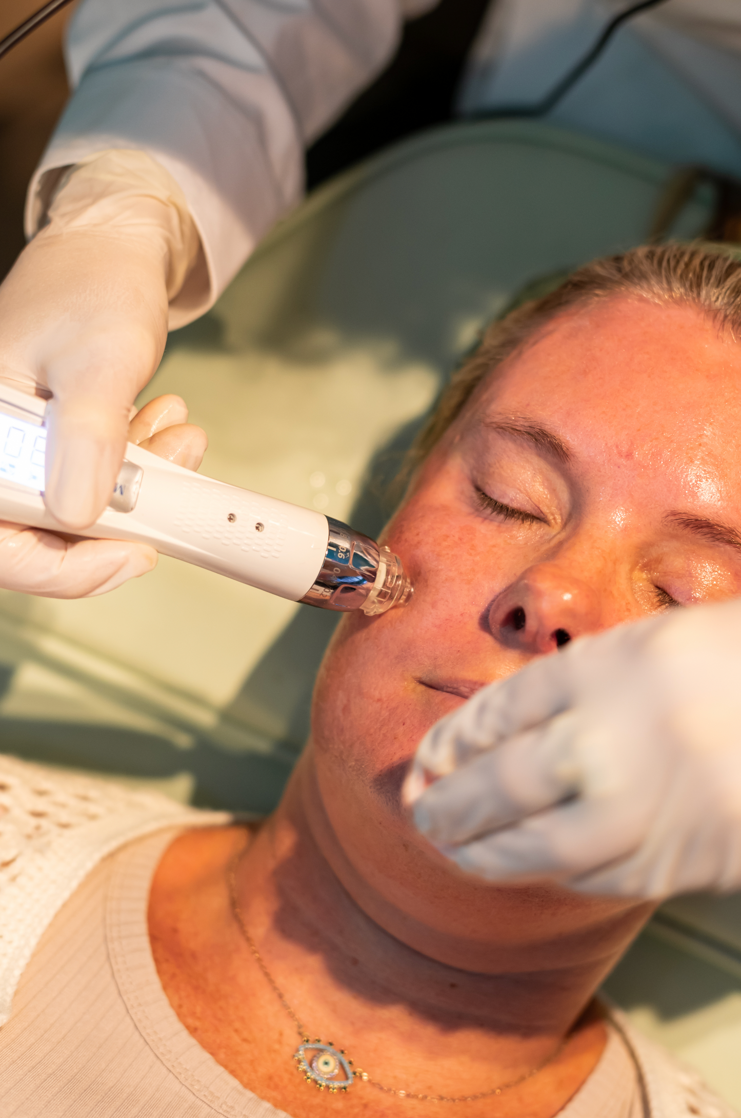 Winter New Client Skin Needling Promotion