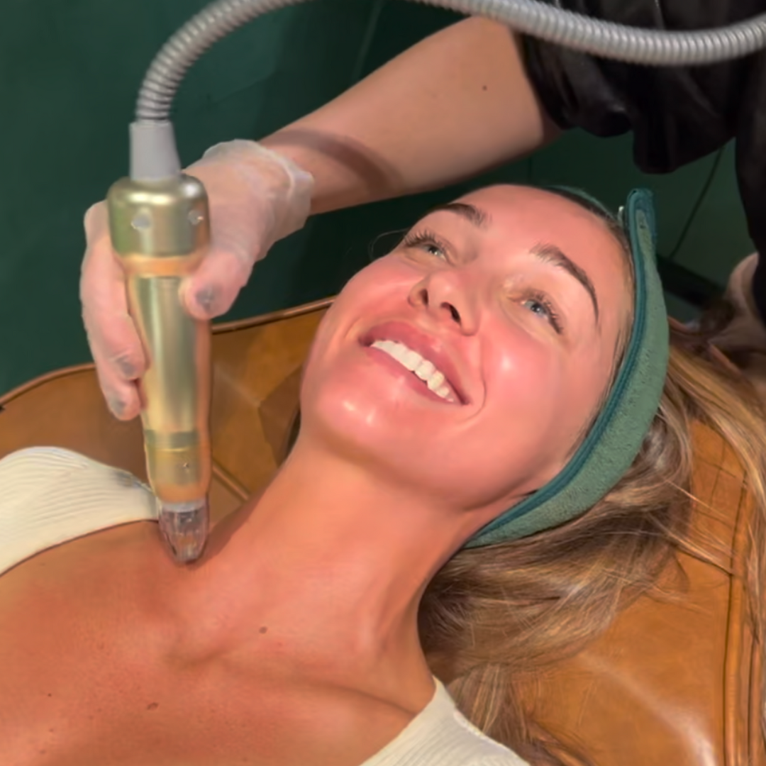 RF Needling x 6 Series