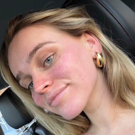 Combination Skin Needling & RF Needling x 6 Series