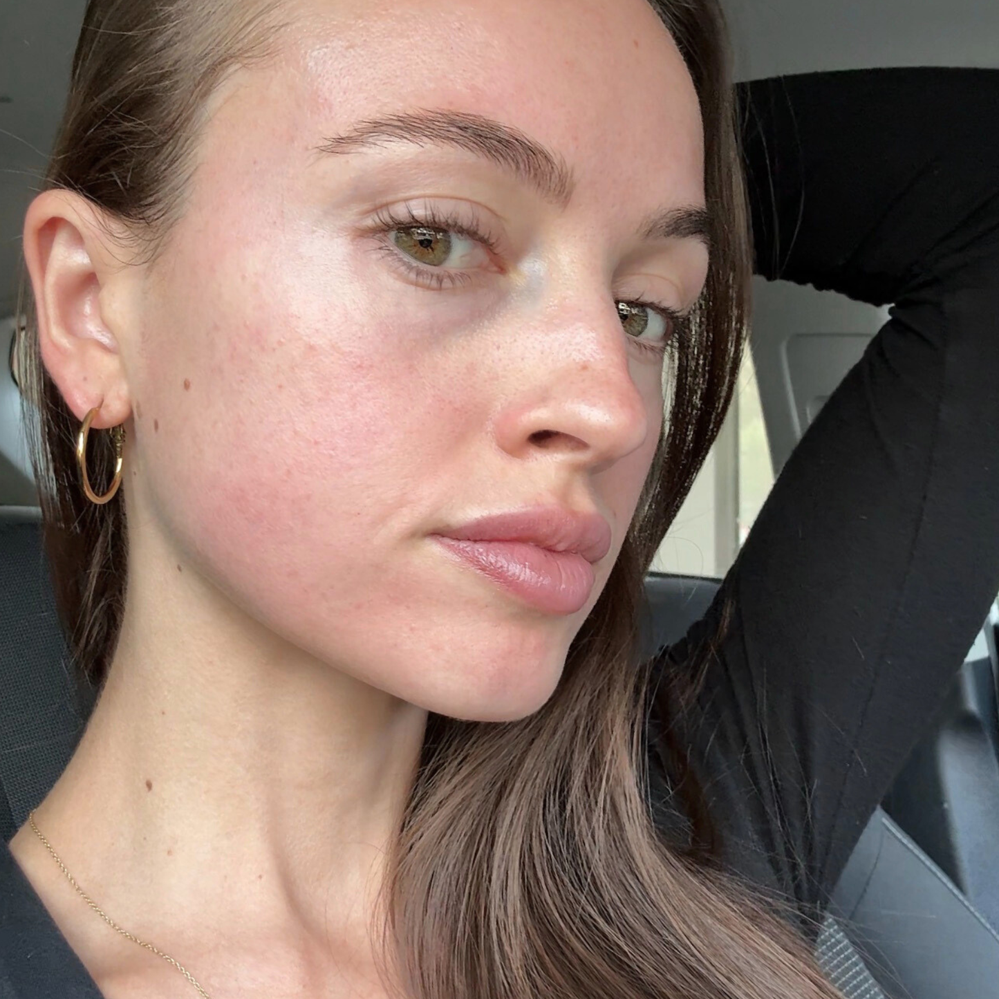 Skin Needling x 3 Series