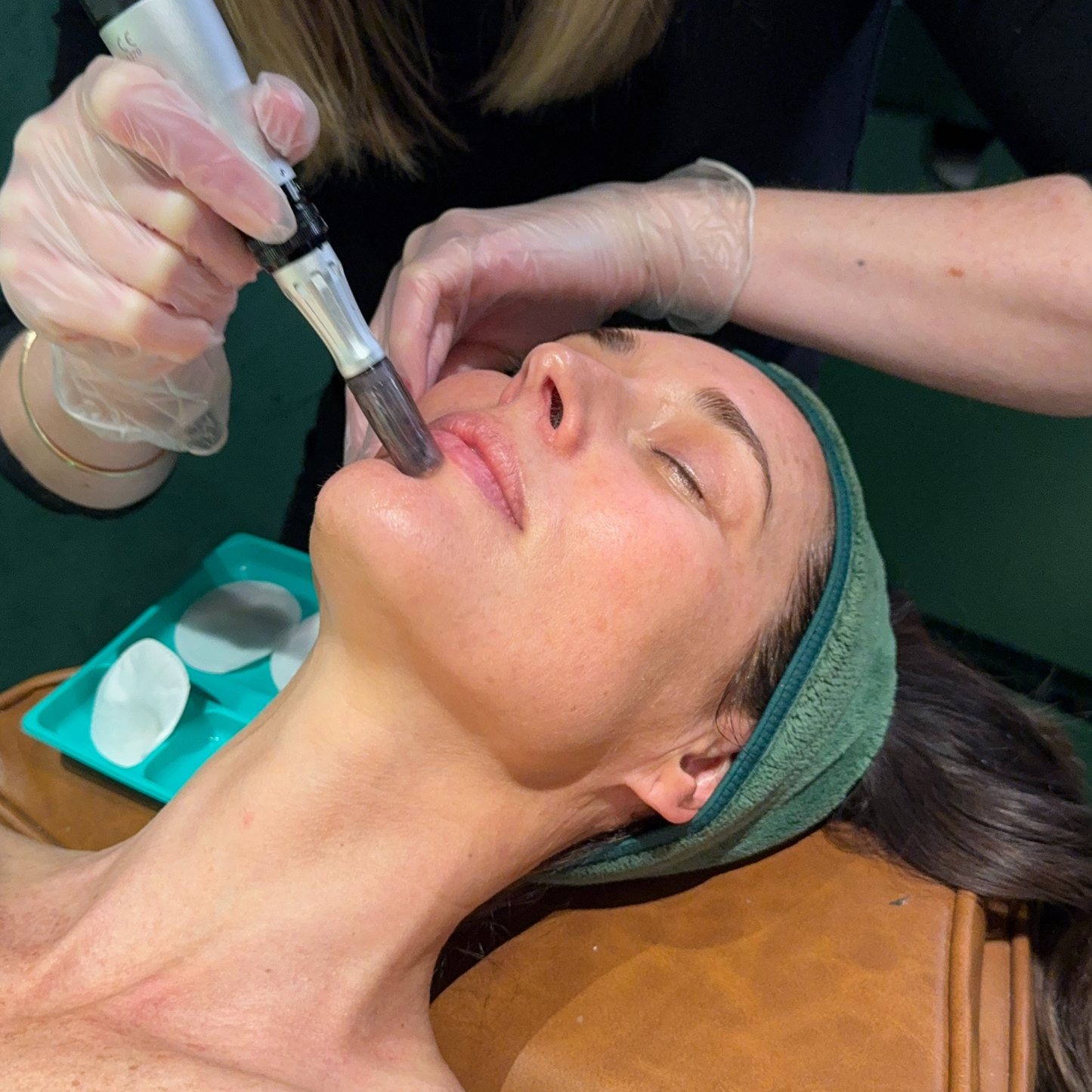 Skin Needling x 3 Series