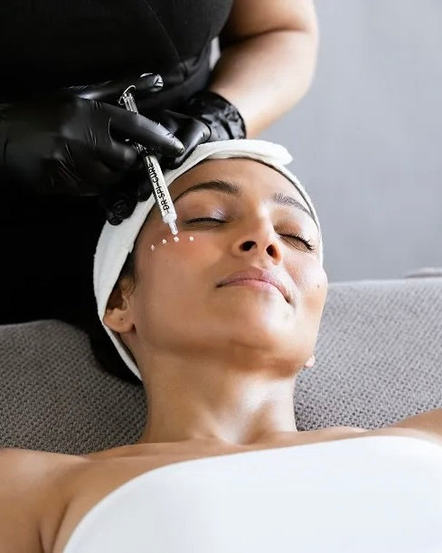 K-Beauty Spicule Treatment
