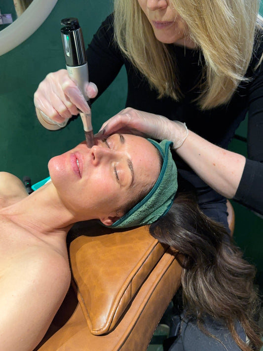 Post-Treatment: Aftercare for Skin Needling