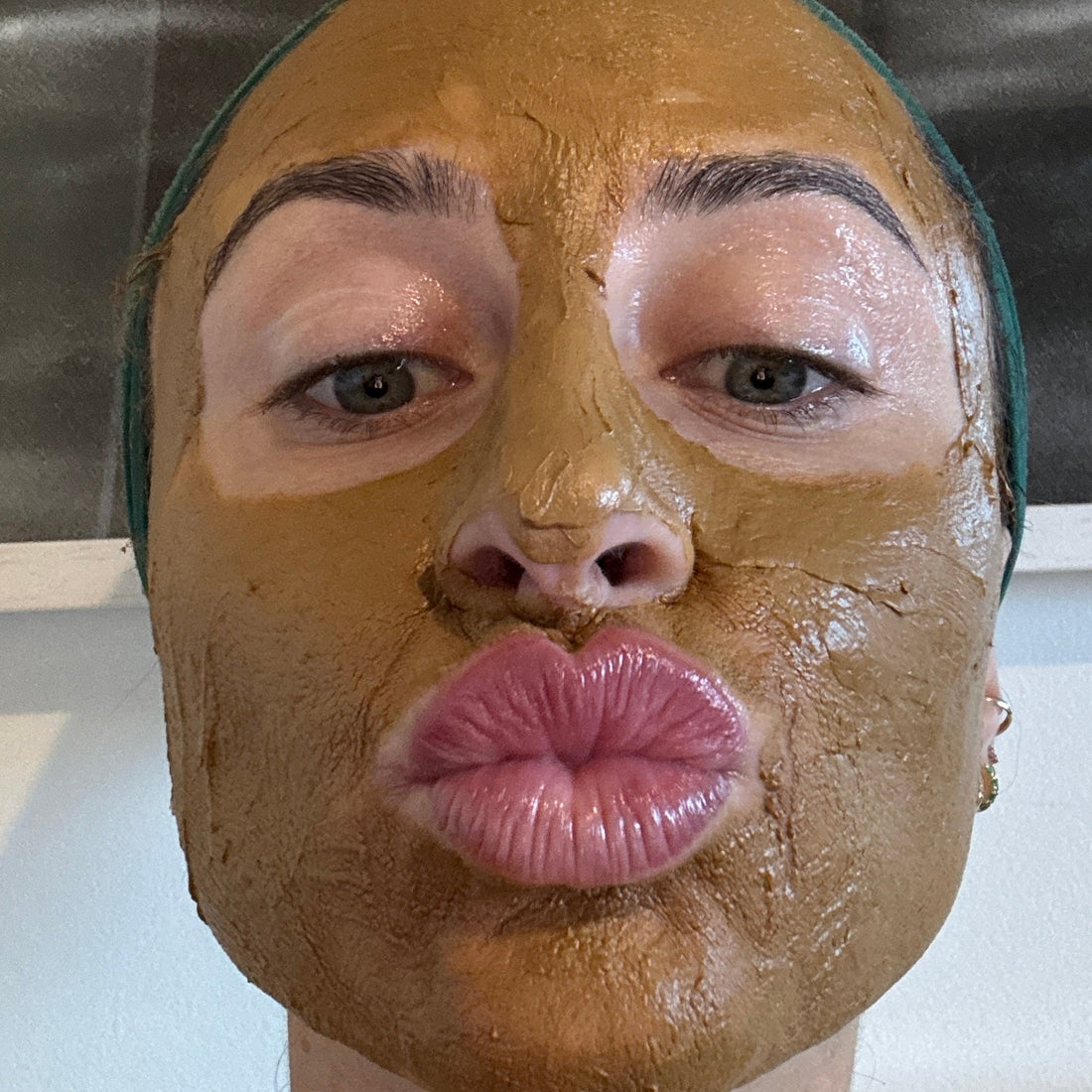Your Ultimate Solution for Pigmentation at The Skin Bar