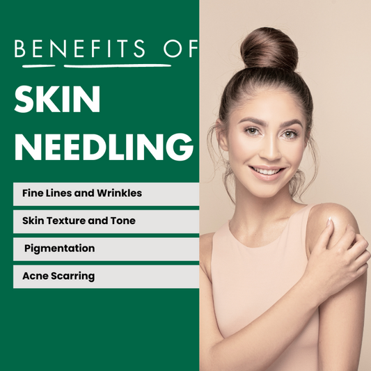 The Benefits of Skin Needling