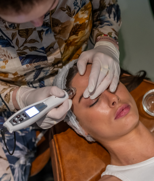 Unlocking the Secrets of Skin Needling