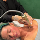 RF Needling x 6 Pack