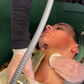 RF Needling x 6 Pack