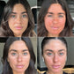 Cosmelan Peel
