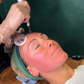 Skin Needling x 3 Pack
