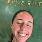 Winter New Client Skin Needling Promotion