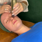RF Needling