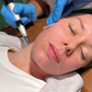 Skin Needling x 3 Pack