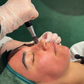 Winter New Client Skin Needling Promotion