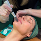 Winter New Client Skin Needling Promotion