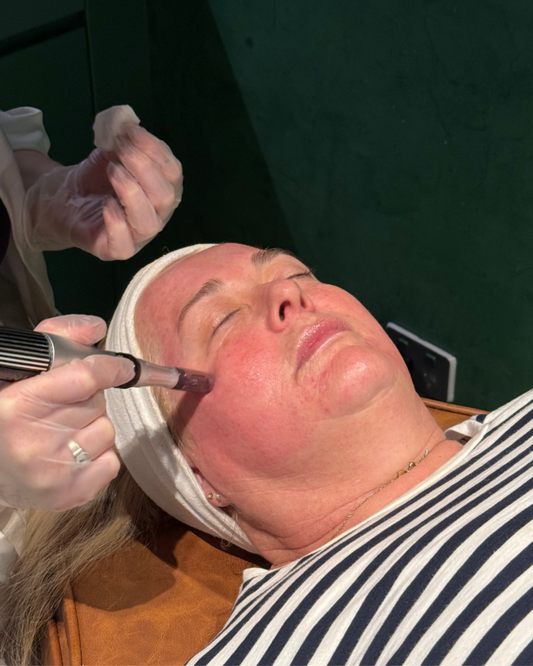 Skin Needling x 3 Pack