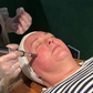 Winter New Client Skin Needling Promotion