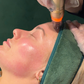 First-Time RF Needling with Consultation & LED - Online Exclusive