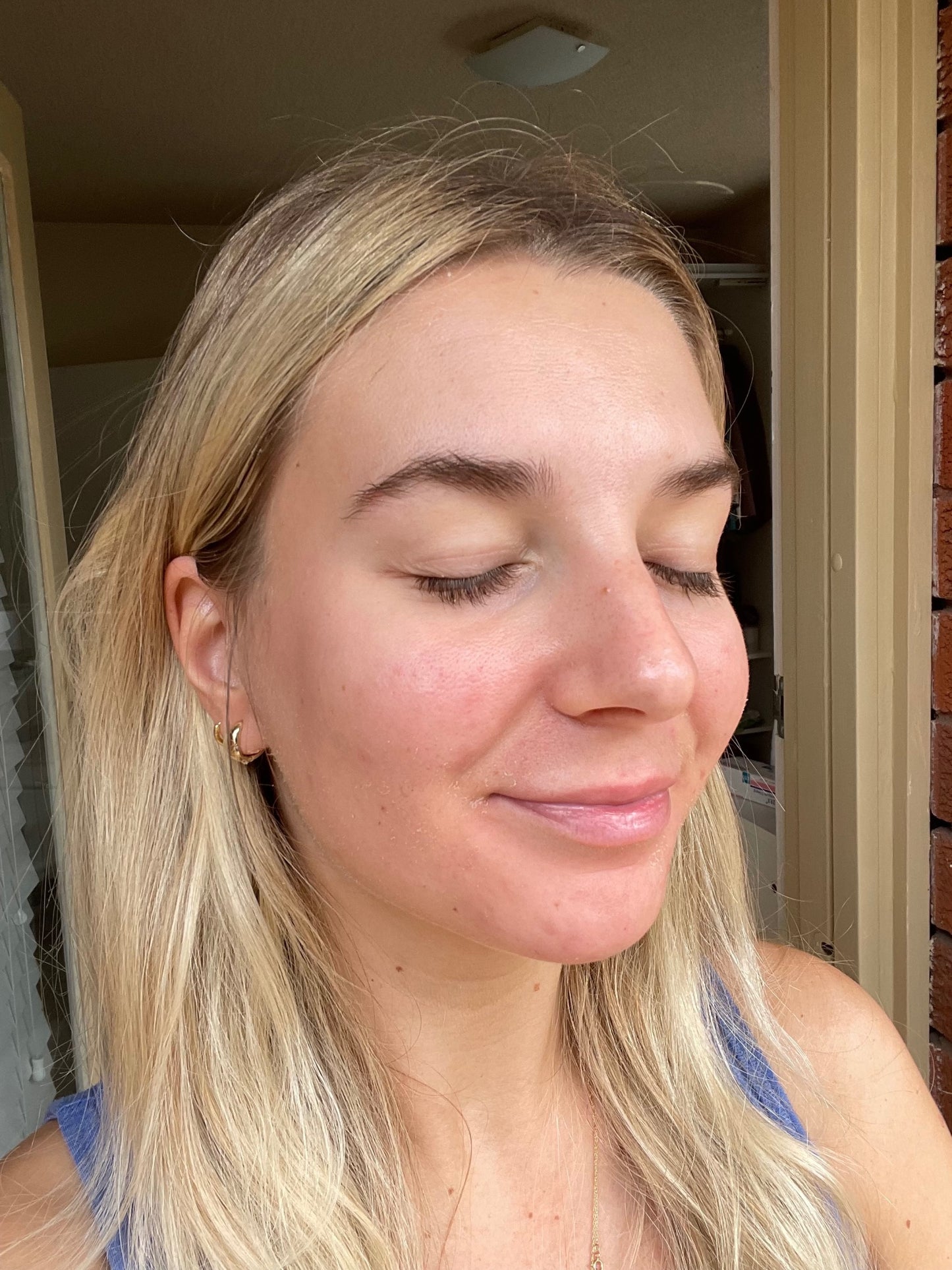 New Client | Skin Needling + Skin Consultation + LED | Narrabeen