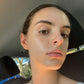 Winter New Client Skin Needling Promotion