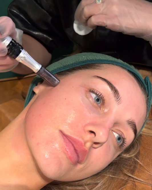 New Client | Skin Needling + Skin Consultation + LED | Online Only