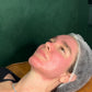 K-Beauty Spicule Treatment