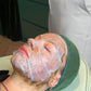 Combination Skin Needling & Spicules x 6 Series
