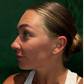 First-Time Skin Needling with Consultation & LED - Online Exclusive