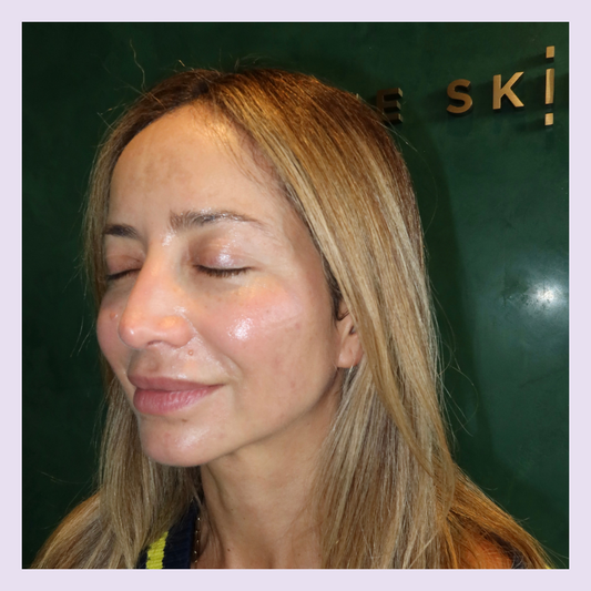 Duet Series - RF Needling