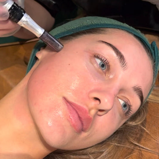 Skin Needling x 3 Pack