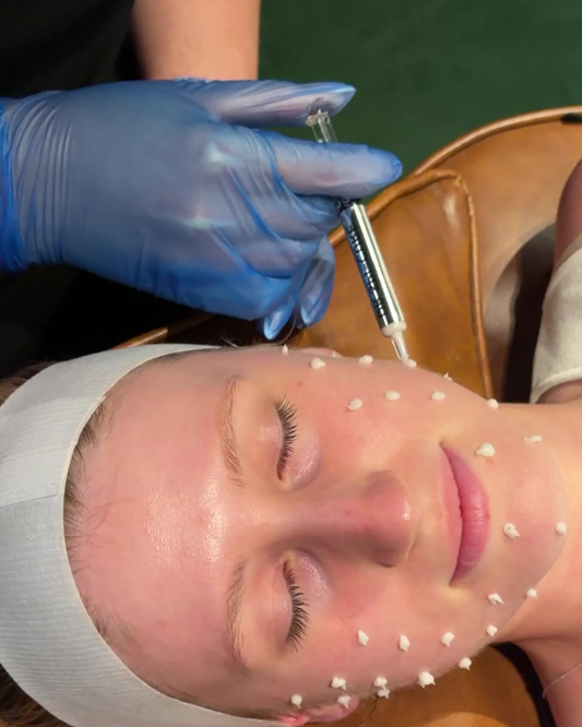 Combination Skin Needling & Spicules x 6 Series