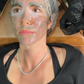Combination Skin Needling & Spicules x 6 Series